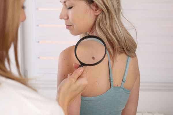 What Are Traditional Skin Lesion Removal Methods Wakefield?