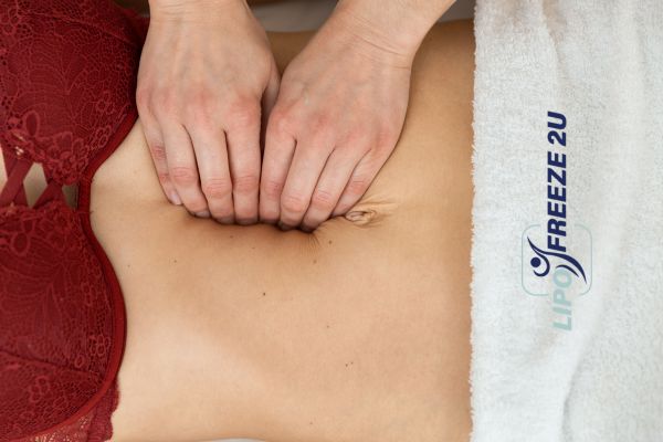 diastasis recti treatment Wakefield