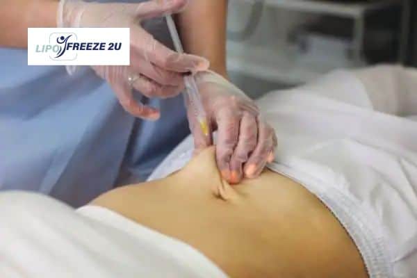 Fat Dissolving Injections Wakefield & Weight loss medication