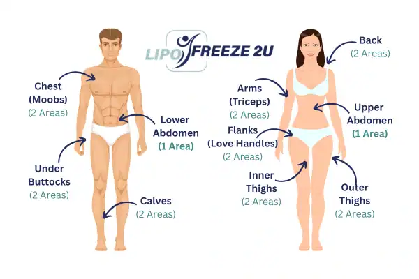 Areas you can have fat freezing treatment Wakefield