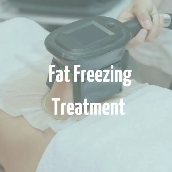 fat freezing treatment Wakefield