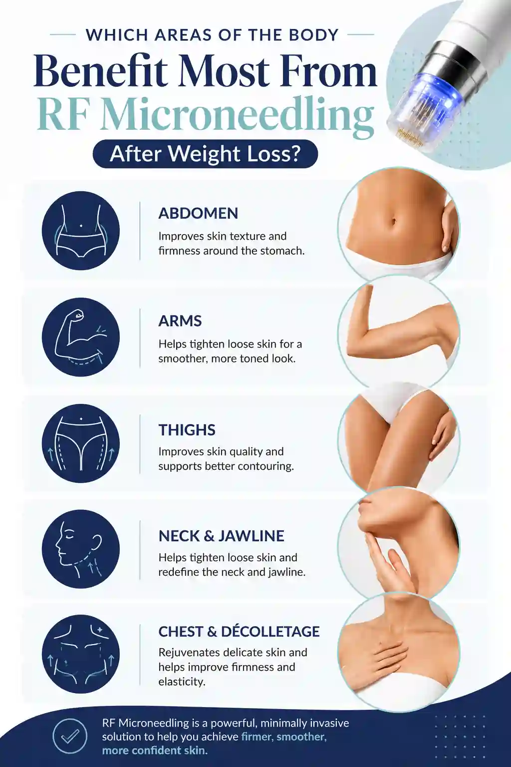 Which Areas of the Body Benefit Most From RF Microneedling After Weight Loss Wakefield